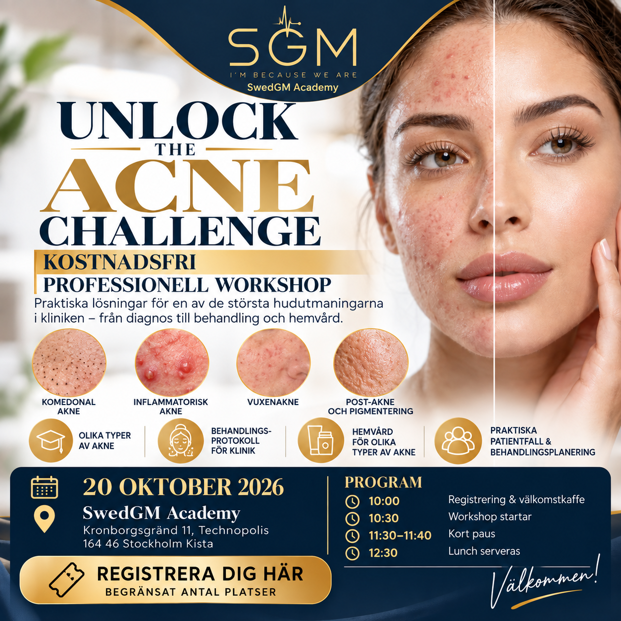 Unlock the Acne Challenge workshop by SwedGM Academy, 20 October 2026, Stockholm Kista